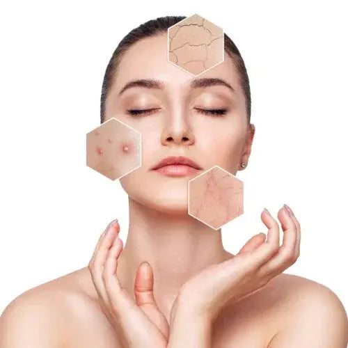 Woman with closed eyes showing common skin concerns like acne, redness, and dryness – ideal for Reversa skincare product targeting sensitive or problem skin